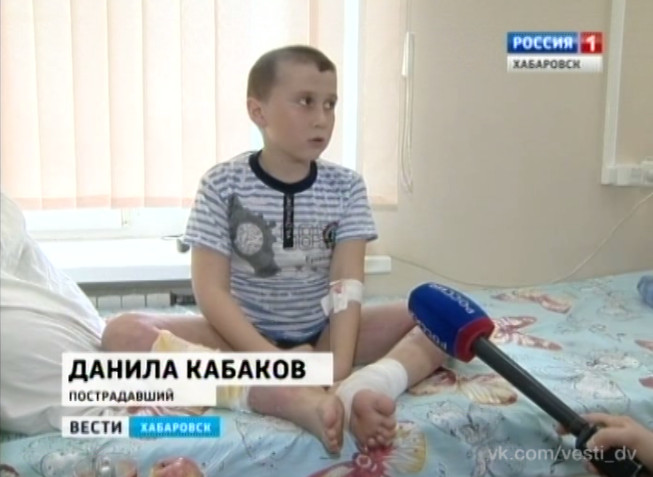 Девятилетний мальчик провалился в яму с кипятком