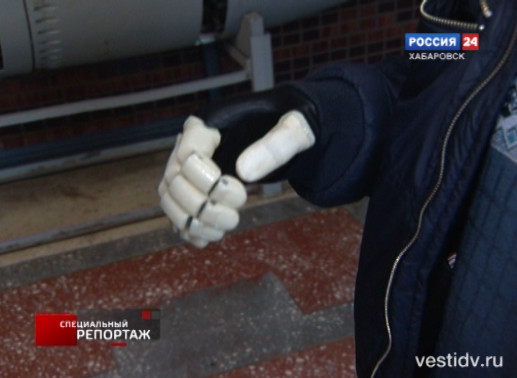 Специальный репортаж. 3D-протезирование