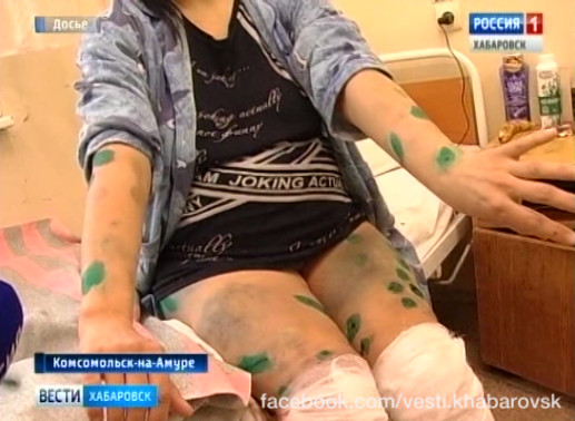 Наказания хозяйке псов не будет
