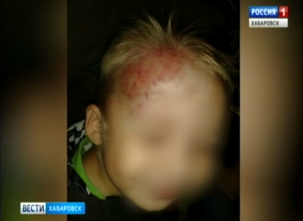 Дети подрались в детском саду