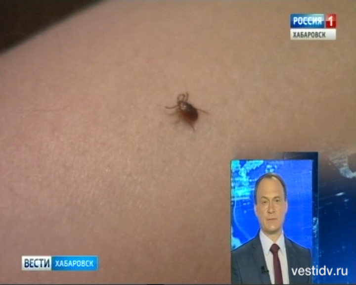 Клещи покусали